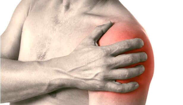 A swollen, red and enlarged shoulder - symptoms of arthrosis of the shoulder joints of the degree 2-3