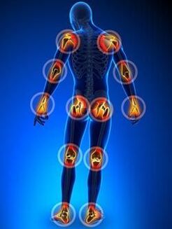 Localization of arthritis affected joints