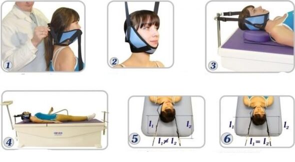 treatment of cervical osteochondrosis using traction