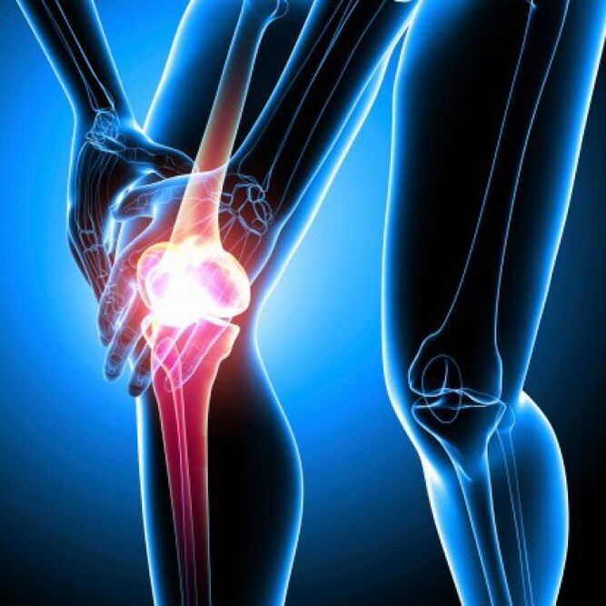 Advanced stage rheumatoid arthritis can cause groin pain