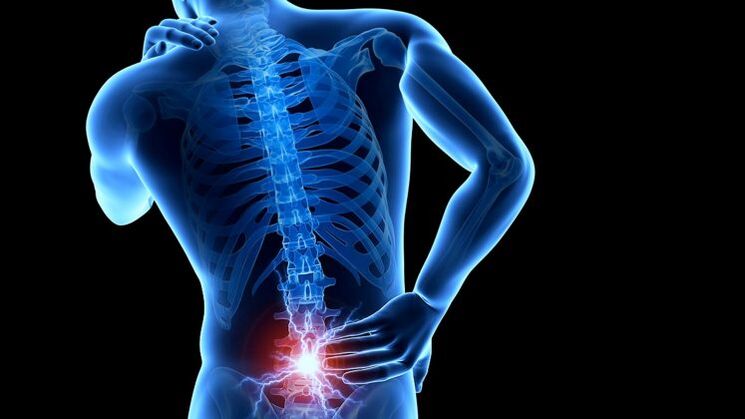 back pain with lumbar osteochondrosis